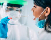 Coronavirus Dépistage