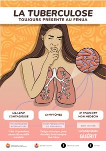 TUBERCULOSE-VF